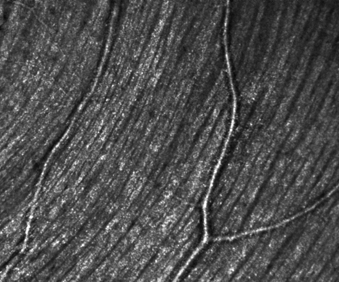 High-resolution microscopic retinal imaging