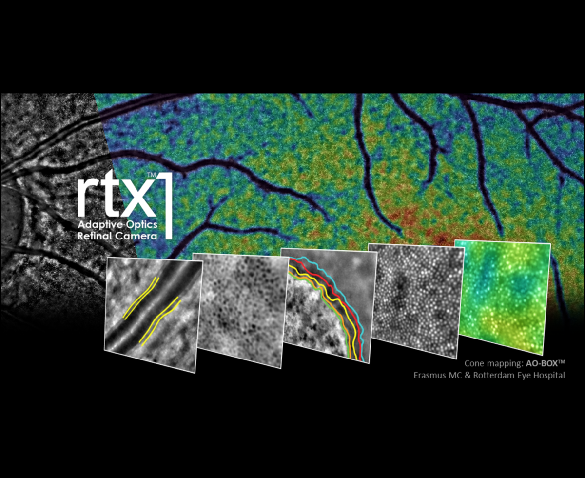 Adaptive Optics Camera